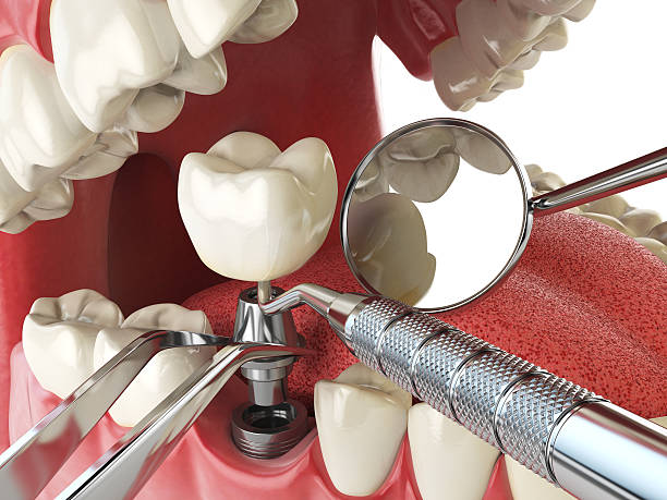Best Knocked-Out Tooth Emergency  in New Market, TN